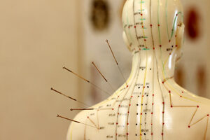 Kurs akupunktury